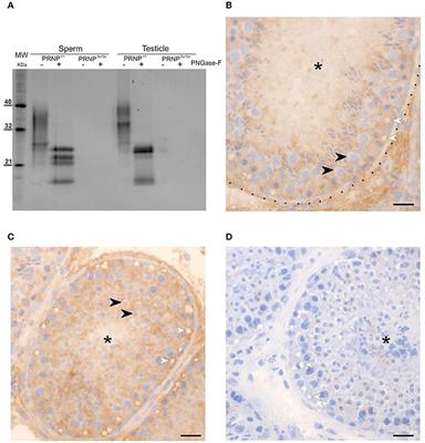 Stress Resilience of Spermatozoa and Blood Mononuclear Cells without Prion Protein